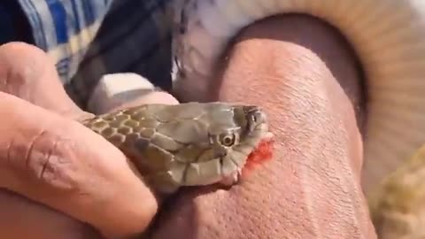 Snake 🐍 attack man danger Snake bite