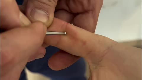 MTC (Medicina Tradizionale Cinese) - 3 rimedi per il mal di gola
