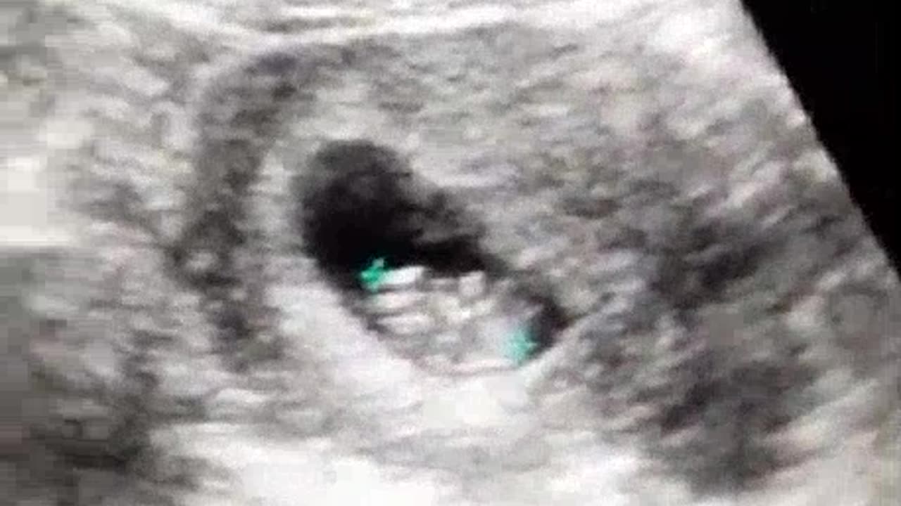 (radiology78) youtube instagram twitter twitch tiktalk dailymotion rumble