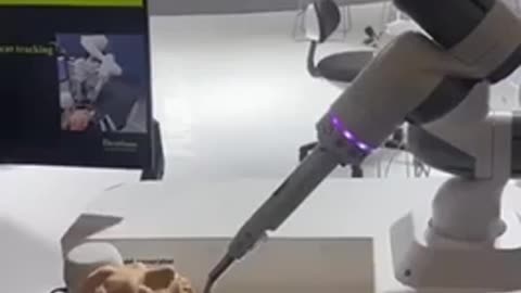 ROBO DENTIST 😳ARE YOU IN?