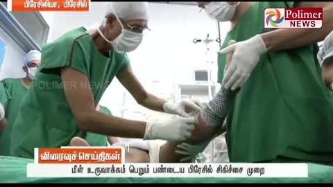 Brazil uses fish skin to treat skin scars !