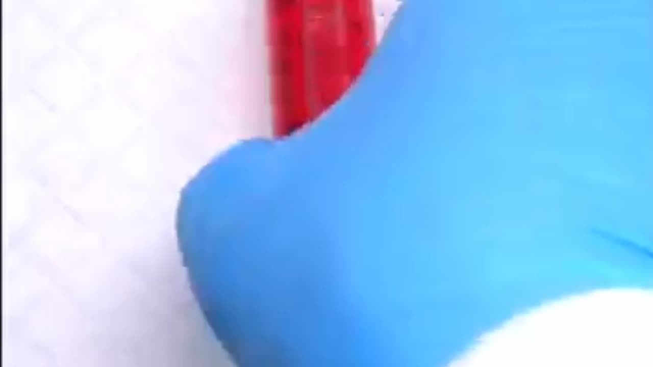 केले का ऑपरेशन हो रहा है
