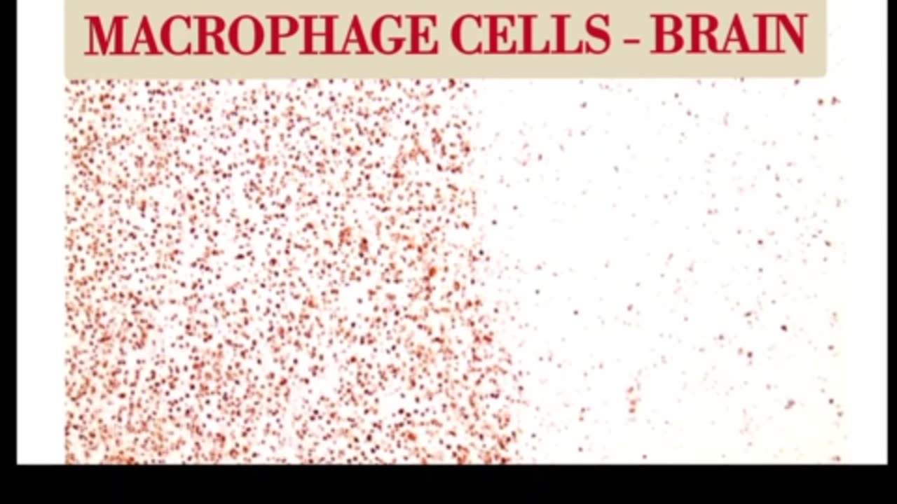 NicMoneypenny PROOF: CAUSATION DATA FOR COVID VACCINE INJURIES