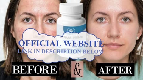 DERMA PRIME PLUS REVIEW – BE CAREFUL!! ⚠️ Does Derma Prime Plus Work Derma Prime Plus Reviews