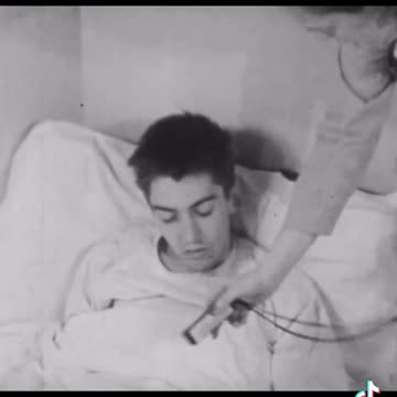 1949 Before and After Lobotomy