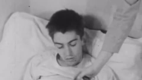 1949 Before and After Lobotomy