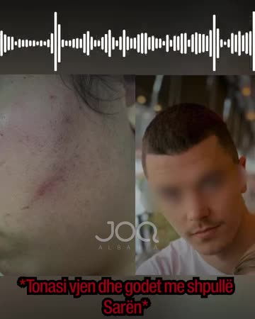 Berisha nxjerr VIDEO-n: Policia është me banditët rilindas