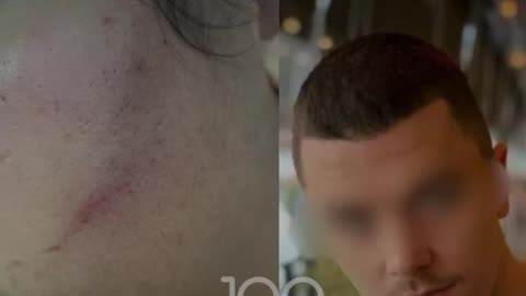 Berisha nxjerr VIDEO-n: Policia është me banditët rilindas