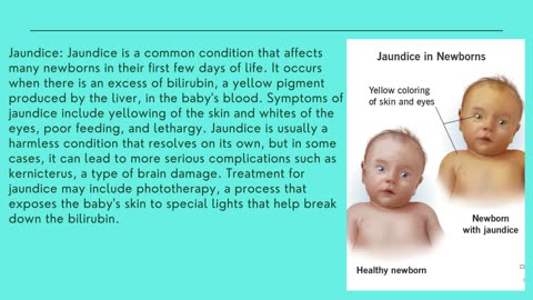 New born disease in the world