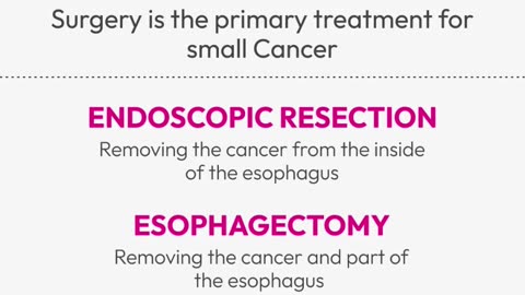 Esophageal cancer treatment Wakad
