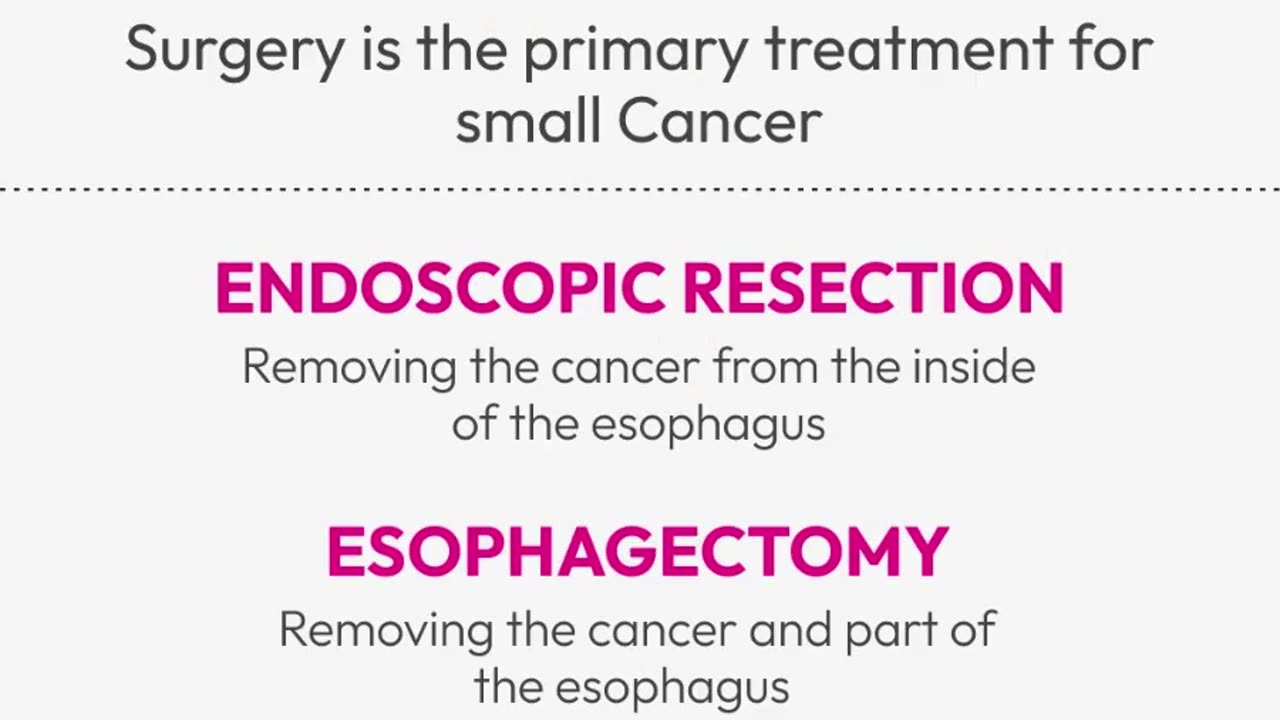 Esophageal cancer treatment Wakad