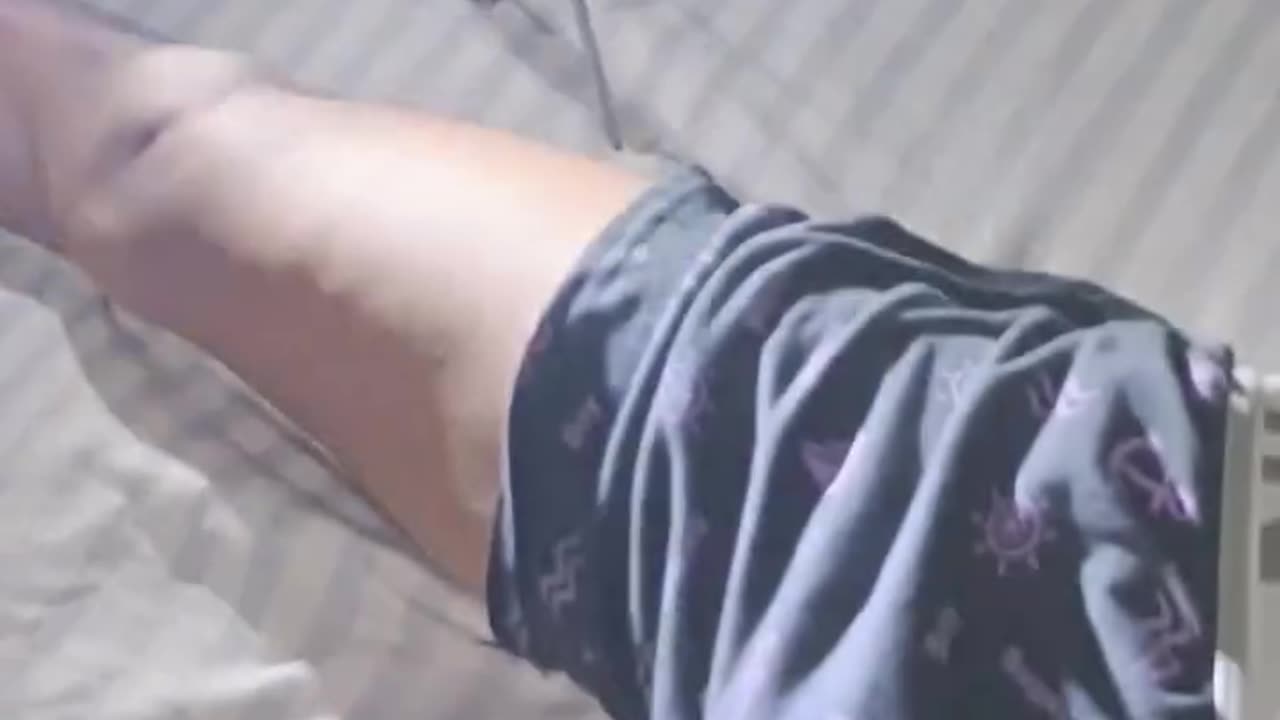 Man wakes up to cobra in his pants.🥶