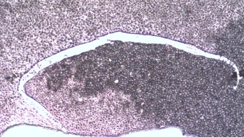Live Blood Under Brightfield Malaria/Filaria Parasites and Graphene Threads & Ribbons. Dr young