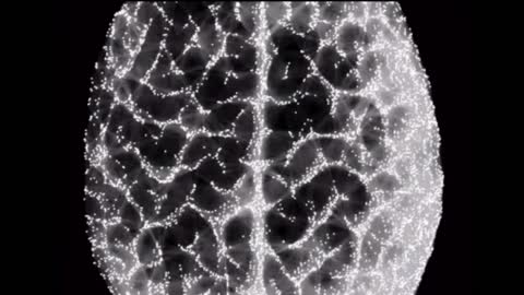 The economic investments in Rev 13:16 τὸ μέτωπον αὐτῶν (in their foreheads)