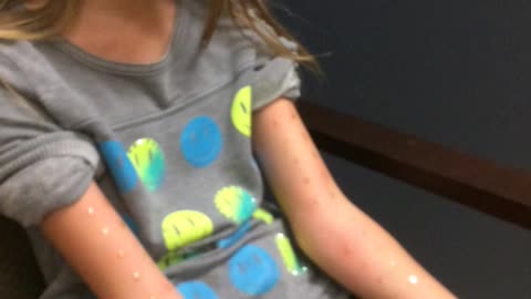 Aly Wilson allergy test