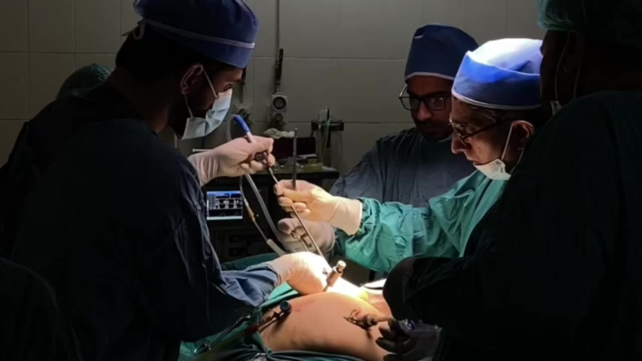 Gallbladder Stones Treatment | Laparoscopic Cholecystectomy