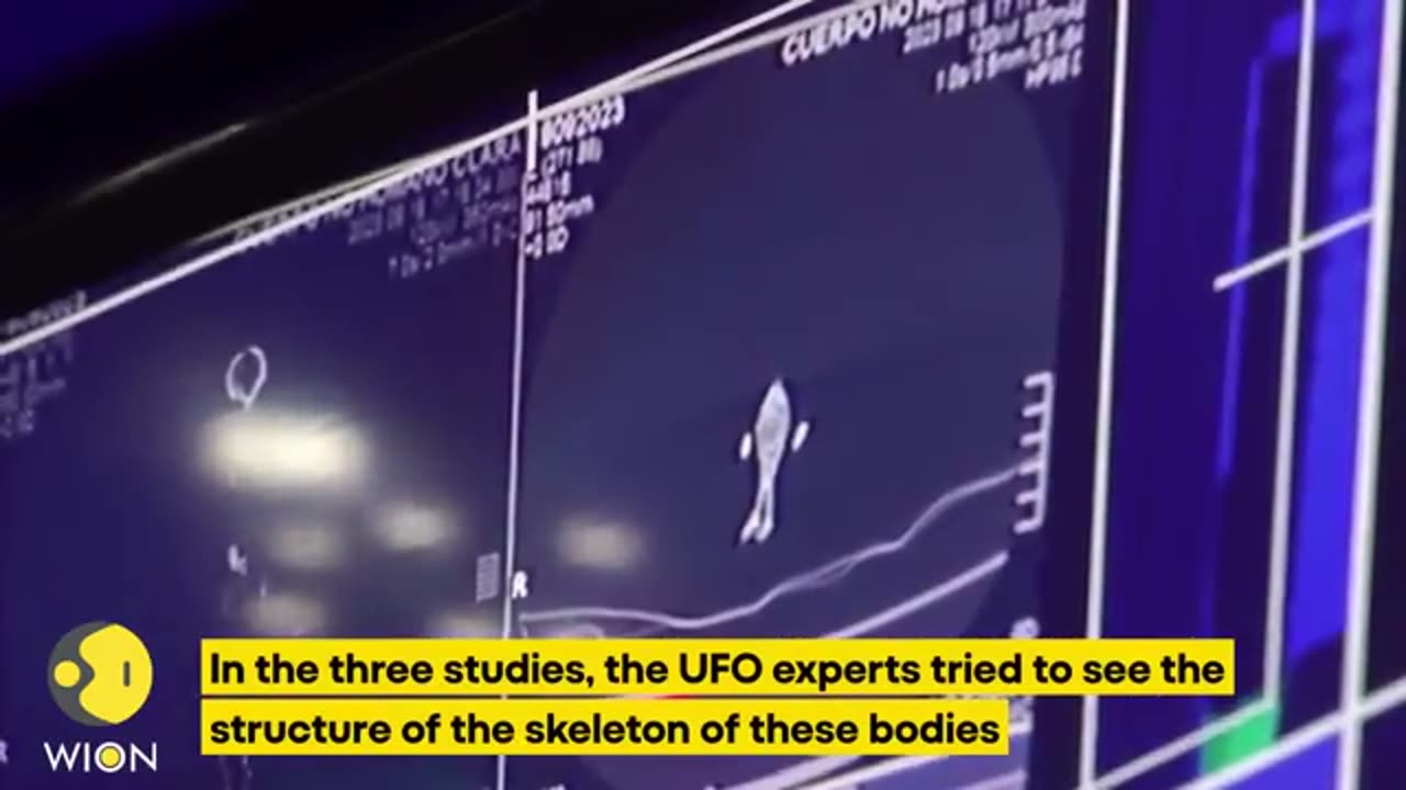 Mexican UFO expert conducts x-rays on non human beings presented at Congress WION Originals