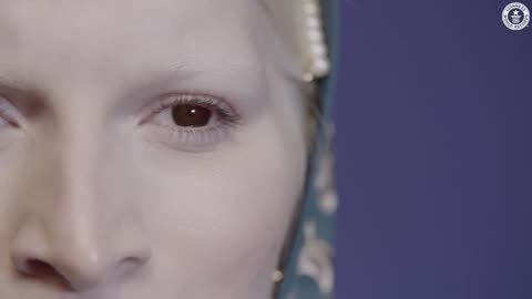 We're Asian, Albino and Beautiful - Guinness World Records