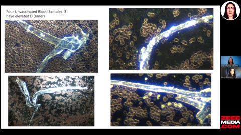Карен Кингстон Ана Михалча COVID гибрид биологического оружия редактирование генов всех людей