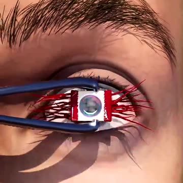 Using a tooth in eye surgery. WTF