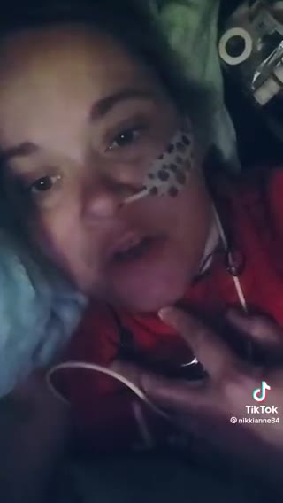 Physical therapist 18 months after the “safe and effective” vax.