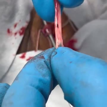 Things unvaccinated persons don’t have to worry about this Christmas:-