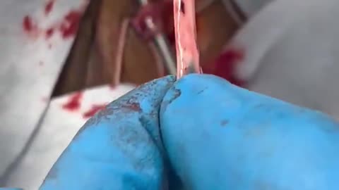 Things unvaccinated persons don’t have to worry about this Christmas:-