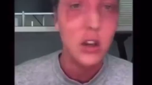 mRNA薬物（コロナワクチン治験薬）を３回打った女性の証言「私は医者の言う事を聞いただけ。政府の言う事を聞いただけ。そしたらこんな人生になった。」