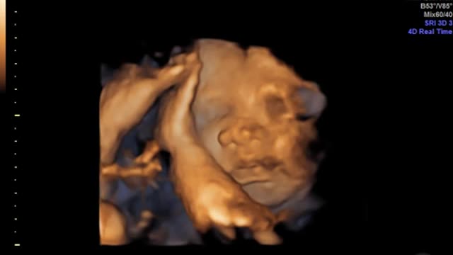 See Your Little One Live with Help of Ultrasound in Atlanta GA