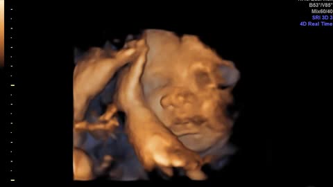 See Your Little One Live with Help of Ultrasound in Atlanta GA