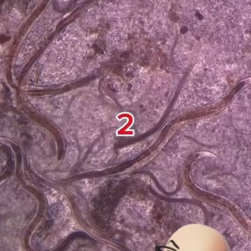 La potenza dell'aglio contro i parassiti intestinali