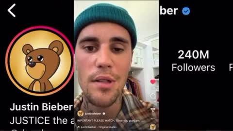 Justin Beiber suffering adverse reactions? Possibly. Probably.