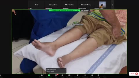 ST3.Examine the legs of this patient Muzammil_1