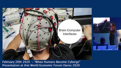 Elon Musk | Brain-Computer Interfaces | "There Are People Like Elon Musk Working On Closed Loop Systems."
