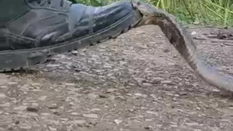 King cobra snake bite on his foot look at this
