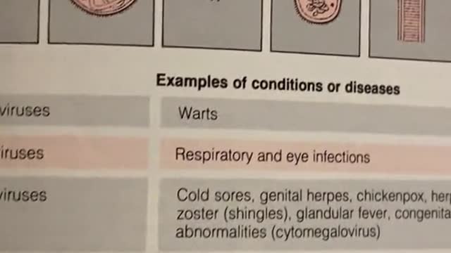 Coronavirus = cold according to American Medical Association Encyclopedia of Medicine