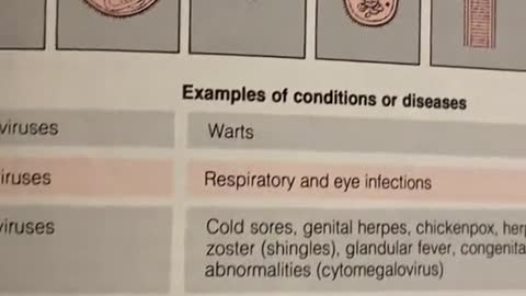 Coronavirus = cold according to American Medical Association Encyclopedia of Medicine