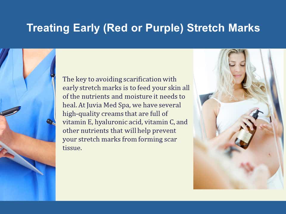 Ways to Remove Stretch Marks After Pregnancy - Juvia Med Spa