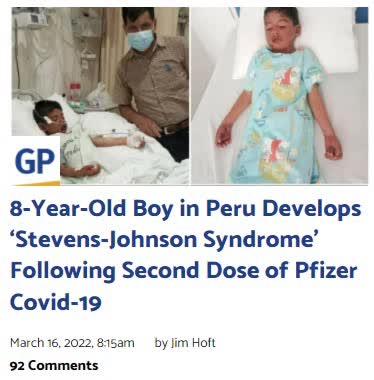 8-Year-Old in Peru Gets ‘Stevens-Johnson Syndrome’ Following Second Dose of Pfizer Covid-19