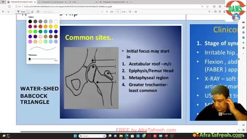 02 Joint Infections (Septic Arthritis TB Hip & knee)