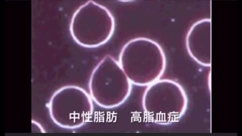 ワクチン接種者と非接種者の血液たった1滴の量を見比べたら驚くべき違いが分かりました