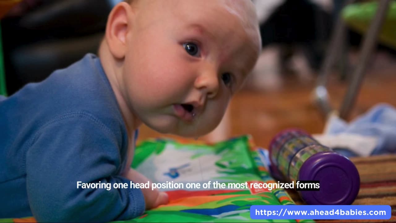 Newborn Misshapen Head Positional Plagiocephaly Treatment