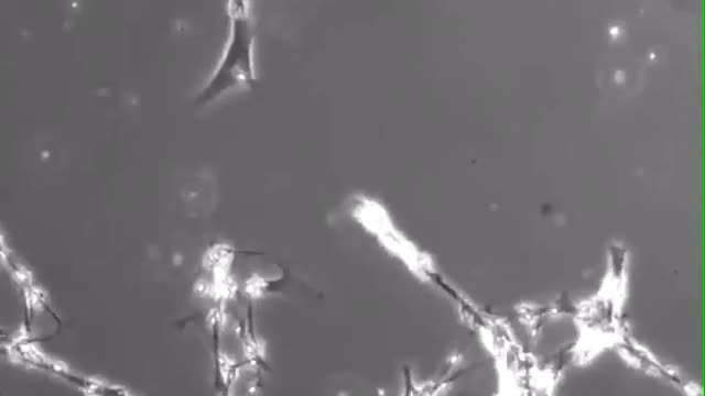 NANO PARTICLES IN BLOOD