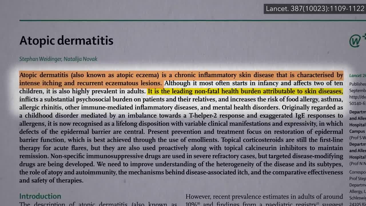 How to Avoid Eczema?