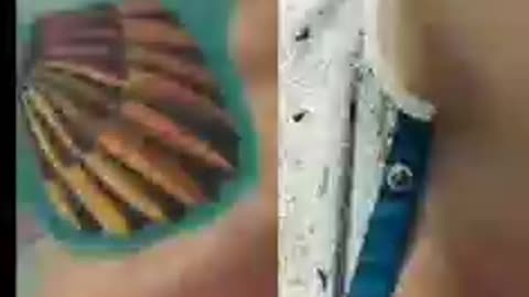 Vaccine INjuries They know what they are doing