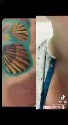 Vaccine INjuries They know what they are doing