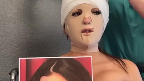 HER NEW FACE… plastic surgery FAIL