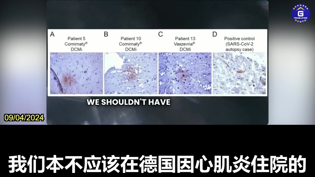 Dr. McCullough: Many research Shows That COVID Vaccine Damage To The Heart