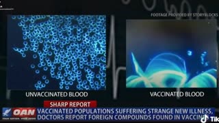 Covid Vaccines and Strokes
