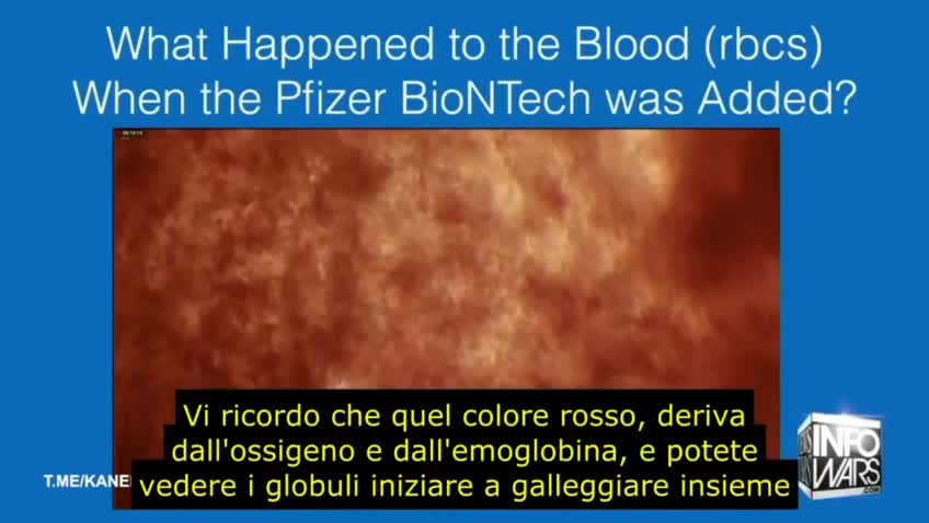 Agghiacciante esperimento, goccia di vaccino a contatto con il sangue visto al microscopio